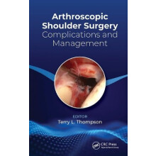 Arthroscopic Shoulder Surgery Complications and Management by Terry Th