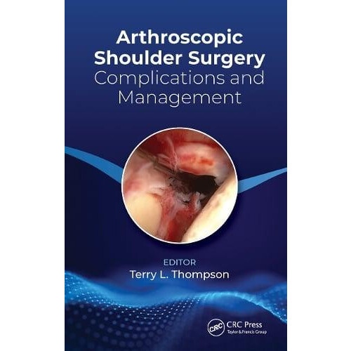 Arthroscopic Shoulder Surgery Complications and Management by Terry Th