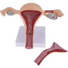 Uterus and Ovary Anatomy Model with Removable Parts