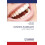 ESTHETICS IN IMPLANTS by AKHIL RATHI Paperback Book 1