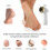 Electric Callus Remover with Touch Control, Three-Speed Adjustable Pedicure Solution for Feet, Rechargeable and Portable Design 4