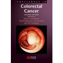 Challenges in Colorectal Cancer 2e by Scholefield Hardcover Book