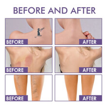 Perfettore di Copertura per il Corpo Bellezza - Trucco per Gambe e Corpo Impermeabile - Correttore per Cicatrici, Macchie, Vene, Tatuaggi e Altro