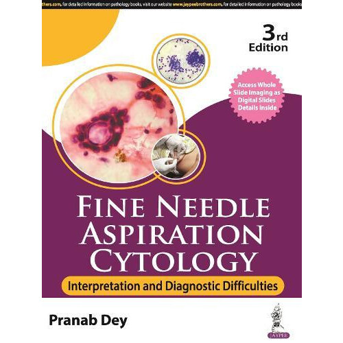 Fine Needle Aspiration Cytology Interpretation and Diagnostic Difficul