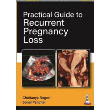 Practical Guide to Recurrent Pregnancy Loss by Chaitanya Nagori Paperb