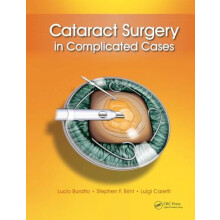 Cataract Surgery in Complicated Cases by Lucio Buratto Hardcover Book
