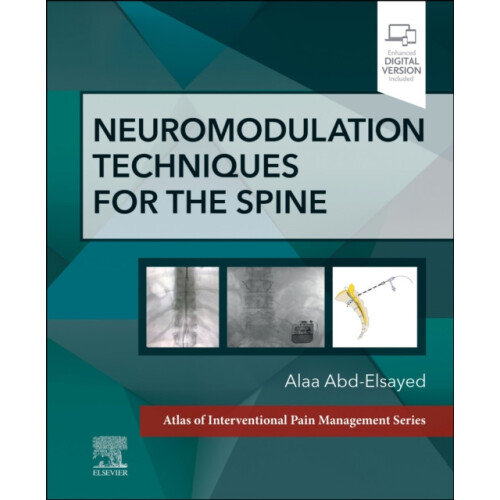 Neuromodulation Techniques for the Spine by AbdElsayed Alaa MD MBA MPH