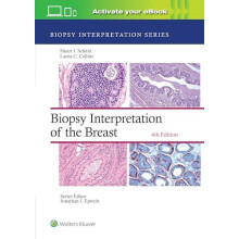 Biopsy Interpretation of the Breast Print book with Multimedia by Stua