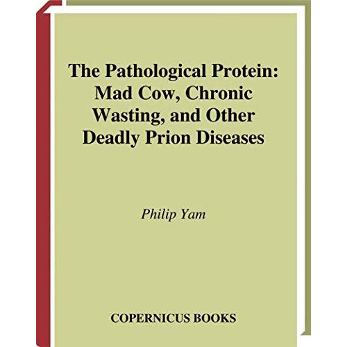 The Pathological Protein Mad Cow Chronic Wasting and Other Deadly Prio