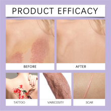 EELHOE Body Concealer Full Coverage Long Lasting Cover Blemishes Natural Finish Professional Waterproof Concealer Natural Color