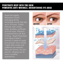 Aloe Vera Eye Gel Patches - Reduce Fine Lines, Dark Circles & Puffiness, Firming & Moisturizing Eye Treatment (10pcs)