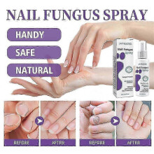 (5) Fungus Spray 100Ml, Fungal Nail Treatment, Advanced Foot and Nail Spray