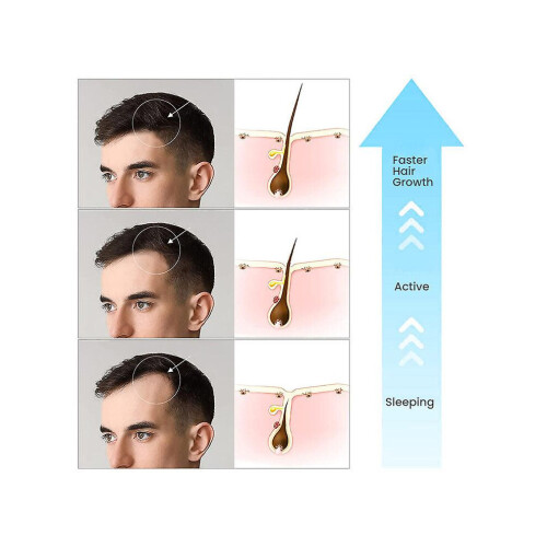 Scalp Reboost Hair Growth Serum 2