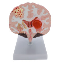 Brain Anatomical Model for Student Nurse Neuroscience Learning Teaching Models