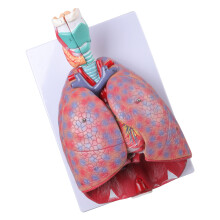 Cardiopulmonary Anatomy Model Respiratory System Cardiac Model Pulmonary Model
