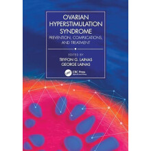 Ovarian Hyperstimulation Syndrome Prevention Complications and Treatme