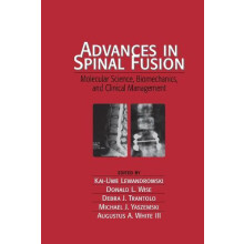 Advances in Spinal Fusion Molecular Science BioMechanics and Clinical