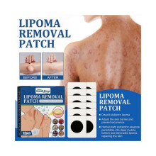 South Moon Fat Knot Repair Patch Soothes Various Fat Knots in the Body, Dissolves Subcutaneous Lumps, and Care Patch