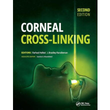 Corneal CrossLinking by Farhad Hafezi Hardcover Book