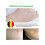 Tea Tree Acne Pimple Patch Pimple Removal Sticker Skin Care Patch 3