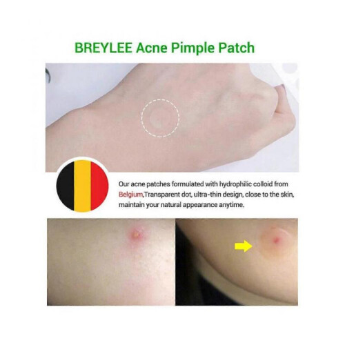 Tea Tree Acne Pimple Patch Pimple Removal Sticker Skin Care Patch 2