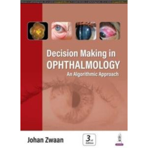 Decision Making in Ophthalmology An Algorithmic Approach by Johan Zwaa