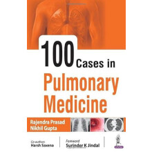 100 Cases in Pulmonary Medicine by Rajendra Prasad Paperback Book