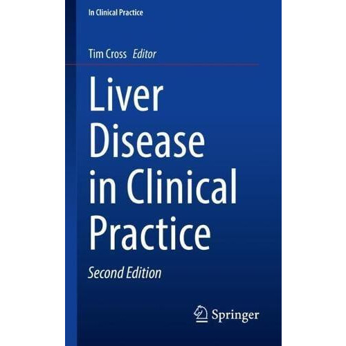 Liver Disease in Clinical Practice Paperback Book