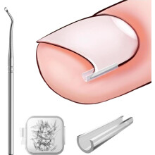 Eingewachsene Zehennägel Korrektur Set – 40 Glättungsstreifen mit Nagelhaken