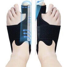 par hallux valgus-korrigeringsskenor med 2 vinkelfästen – halkfria tåavskiljare