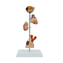Diabetes Pathology Human Organ Anatomy Model