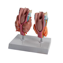 Anatomical Pathological Thyroid Model Human Pathological Thyroid Anatomy Model