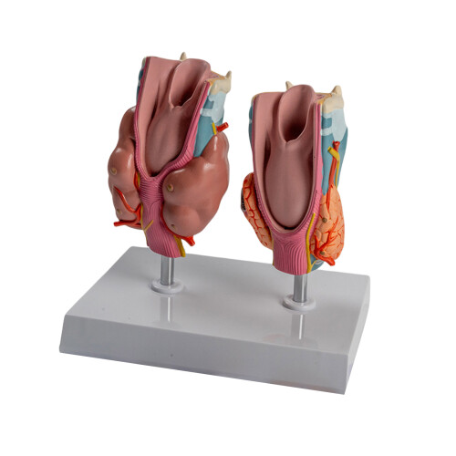 Anatomical Pathological Thyroid Model Human Pathological Thyroid Anatomy Model