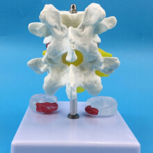 Cervical Vertebra Arteria Spine Spinal Nerves Anatomical Model for Natural big three lu