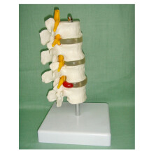 Vertebra Model Cervical Spine with Neck Artery Occipital Bone Disc Natural big five lum