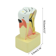 Practical Dental Pathology Model 4 Times Periodontal Disease Analysis for Child