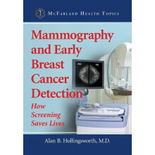 Mammography and Early Breast Cancer Detection How Screening Saves Live