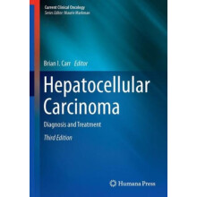 Hepatocellular Carcinoma Diagnosis and Treatment Paperback Book
