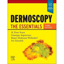 Dermoscopy by Zalaudek Iris MD ChairDirector Department of Dermatology