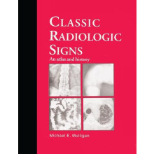 Classic Radiologic Signs by M.E. Mulligan Paperback Book