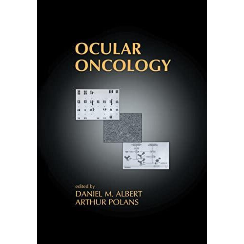 Ocular Oncology Hardcover Book