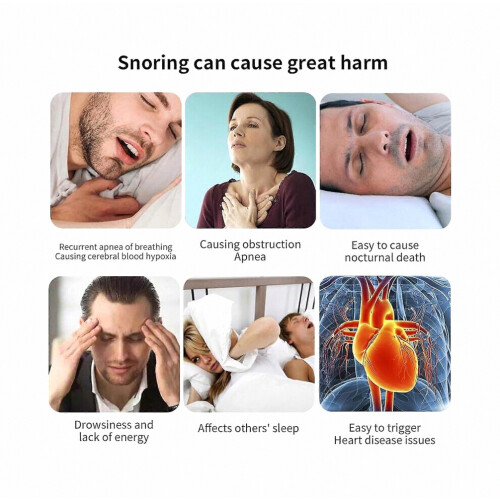Smart Anti-Snoring Massage Device with Automatic Detection and 3-Speed Control compatible Peaceful Sleep_Special Gift 2