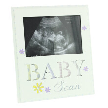 Baby Scan Sonograph Photo Frame - Impressions by Juliana