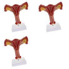3X 1:1 Menselijke Vrouwelijke Baarmoeder Eierstok Eileiders Model Anatomische Menselijke Anatomie Model Leermiddelen