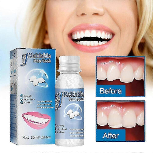 (2pcs) 1-3pcs Temporary Tooth Repair Kit Resin Fix Broken False Teeth Fill Gaps Dental Denture-aac 1
