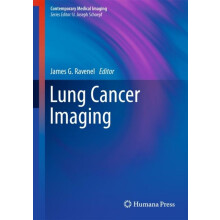 Lung Cancer Imaging Hardcover Book