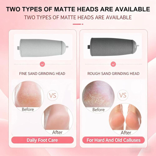 Gentle Foot Scrubber for Feet has a comfortable pink handle steady control while 1