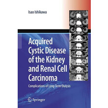 Acquired Cystic Disease of the Kidney and Renal Cell Carcinoma Complic
