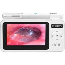 4,3 Inch Digitale Otoscoop HD1080P 3,5mm Oor Picker Oor Camera 6 LEDs Oorsmeer Verwijderingsgereedschap Oor Reinigingsstaafje