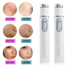 Light Acne Removal Pen, Non-Invasive Mole Removal Pen, Freckle Treatment, Beauty Device, Spot Removal Pen